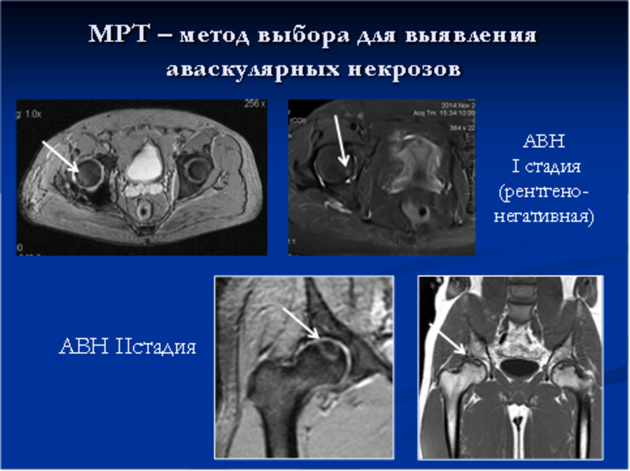 Магнитно-резонансная томография: достоинства метода